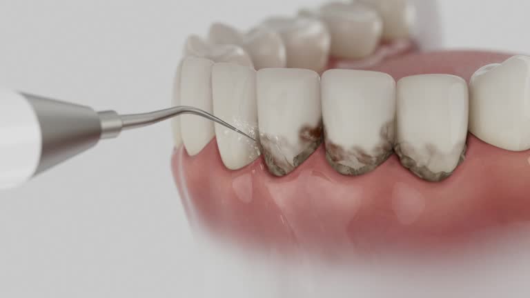 Reliable Emergency Dentist contractor in Steilacoom, WA by Smile Center Dentistry